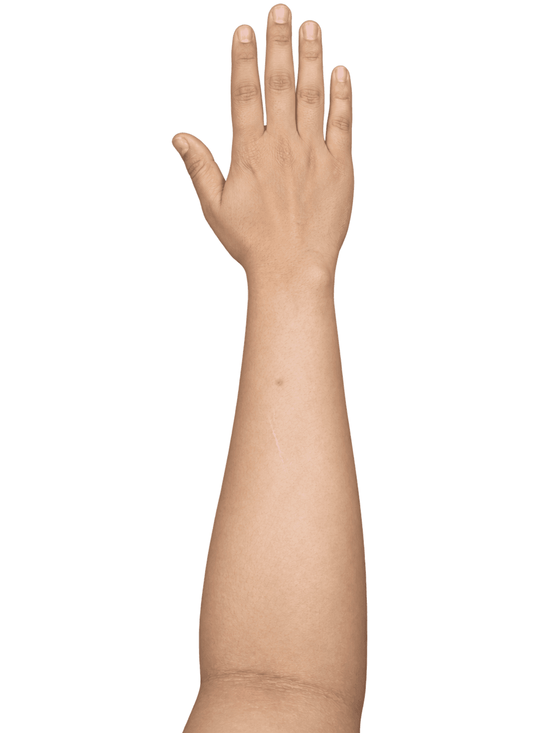 Outer arm and back of hand placement photo